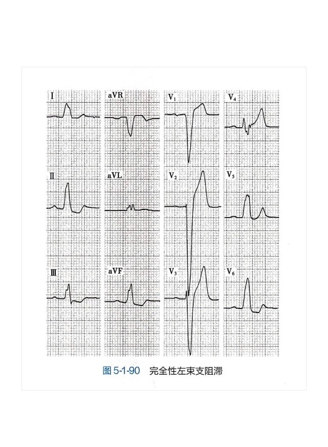 心内提问