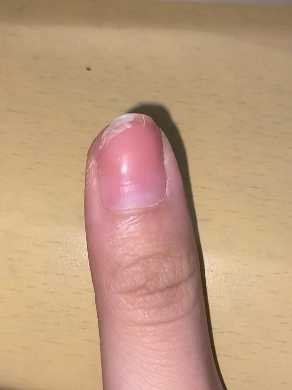 指甲劈成这样可以做美甲保护吗 从指甲中间开始劈 然后很大一块要么没