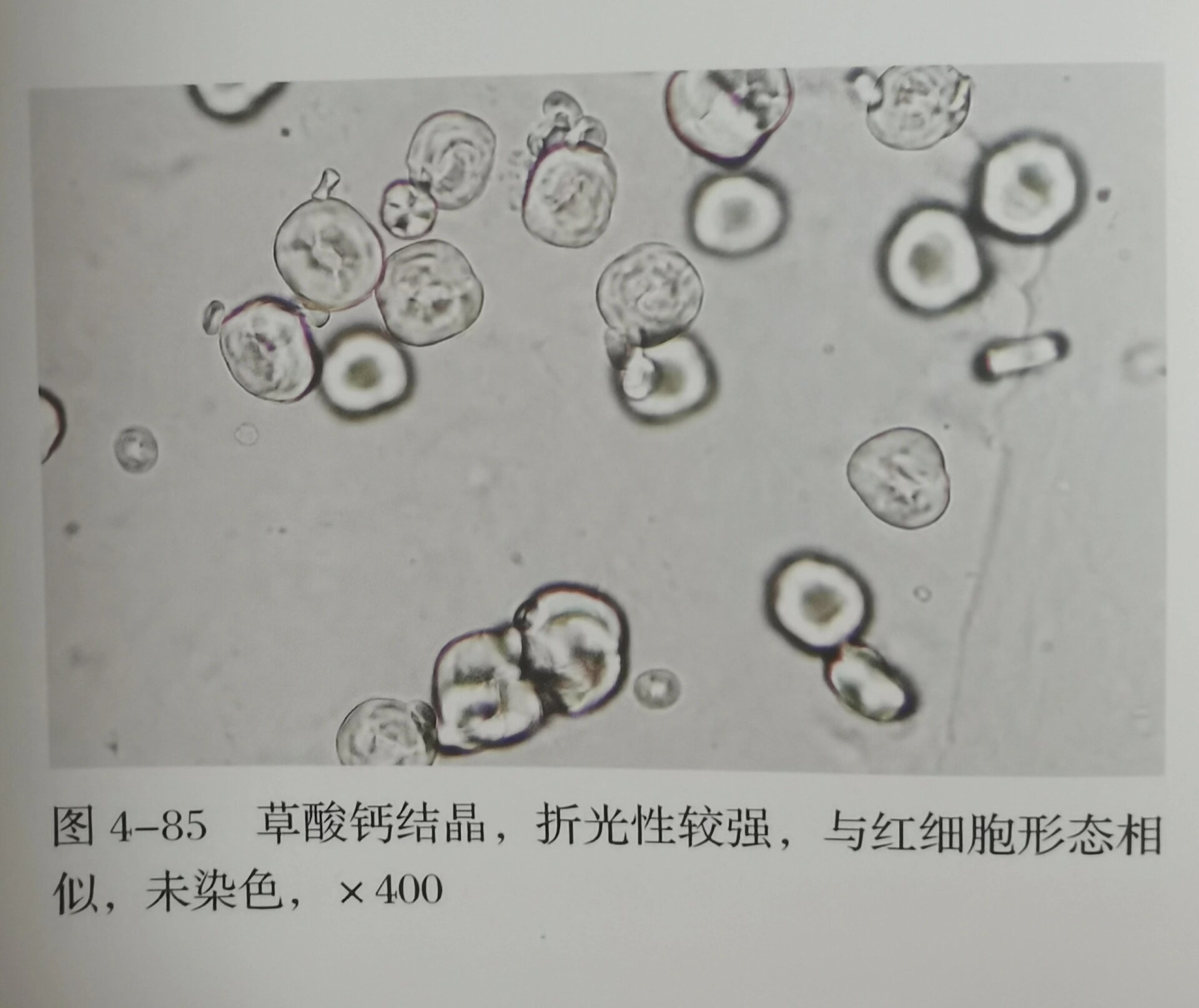 草酸钙簇晶显微图片图片