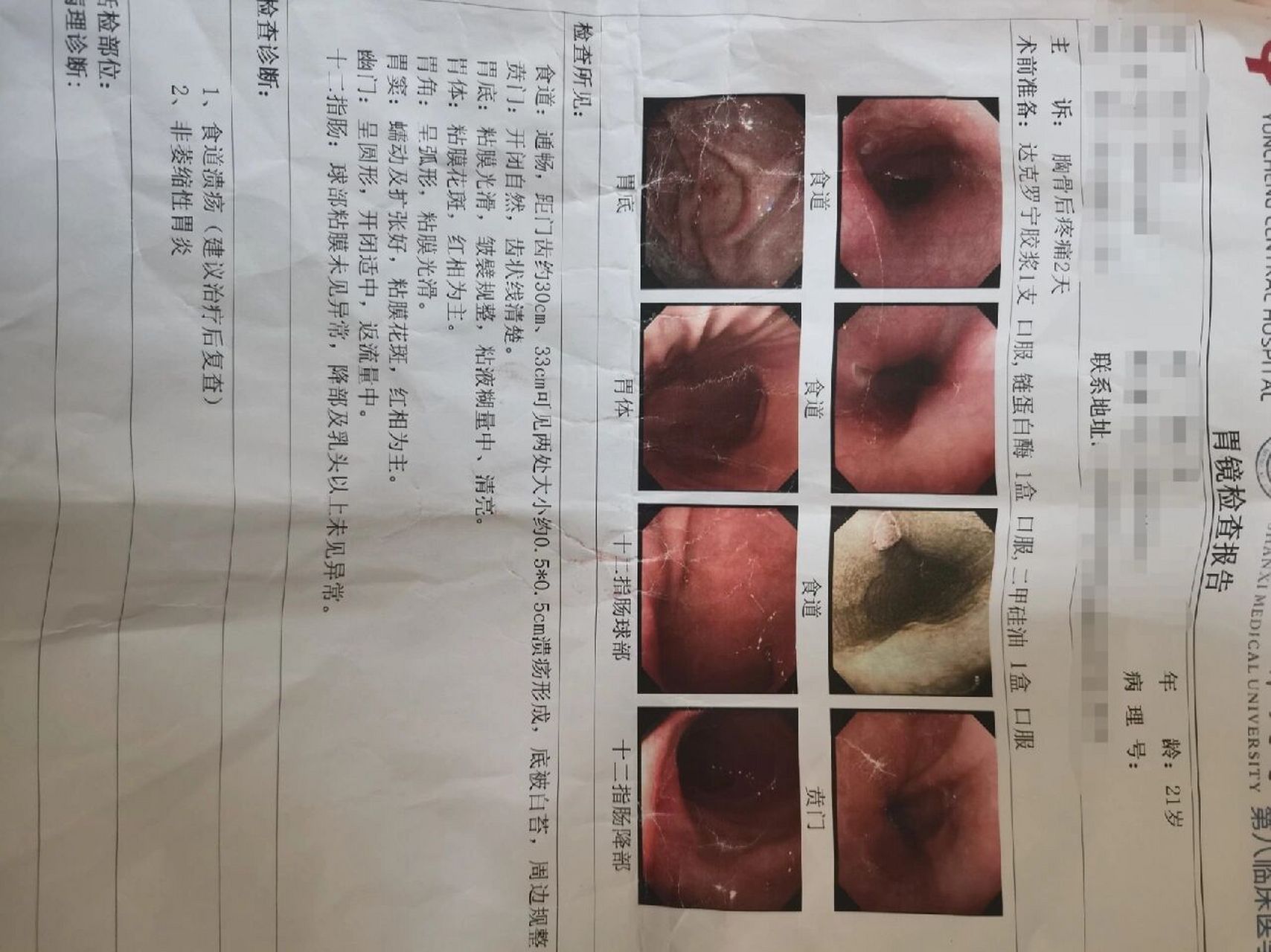 食道糜烂的胃镜图片图片