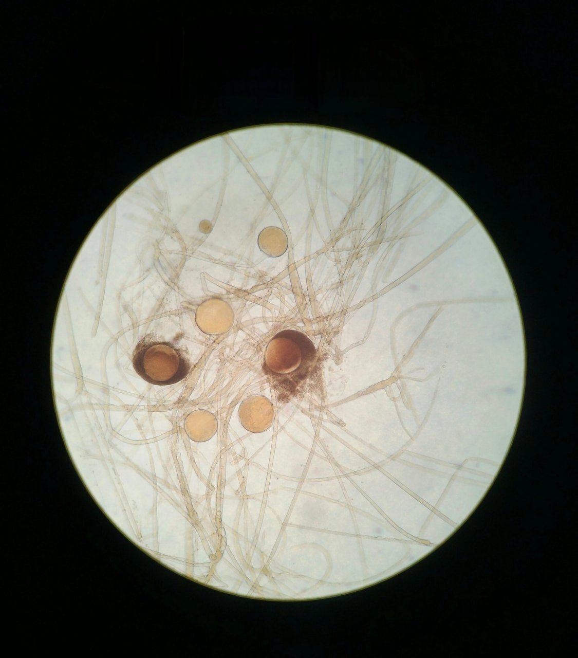 一波不太艺术的细菌真菌 2017压u盘系列 分别为黑根霉,羊肚菌,水霉菌