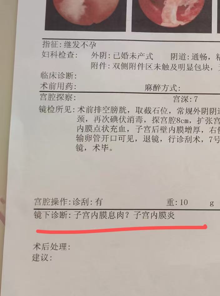 是通过探头放入阴道检查子宫的影像学方法,能看清子宫
