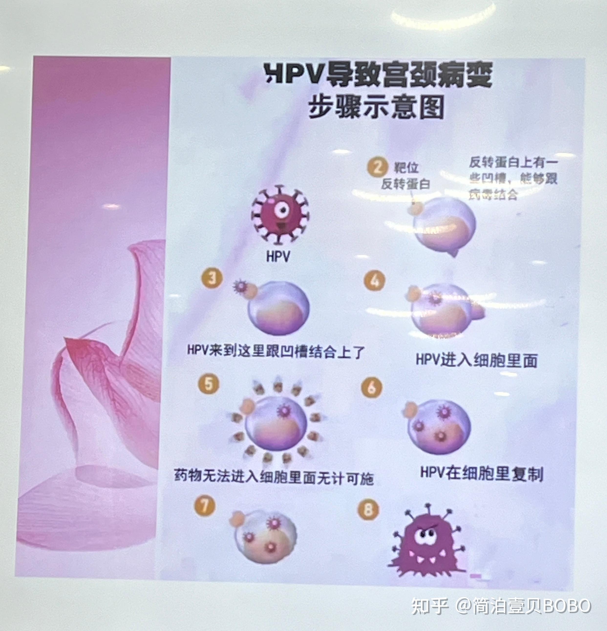 感染hpv咋治疗好hpv病毒需要怎样治疗好