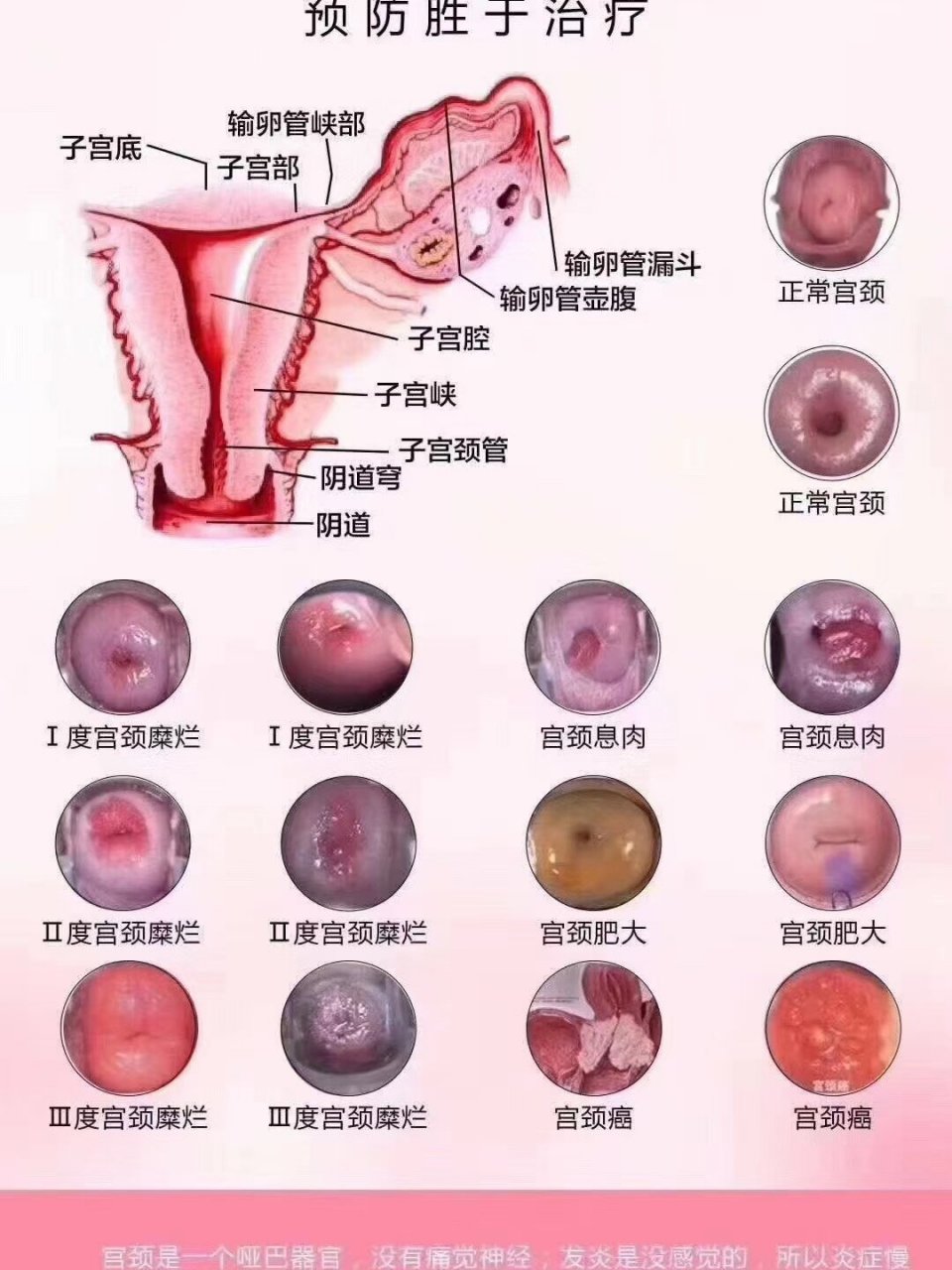 宫底位置图片图片