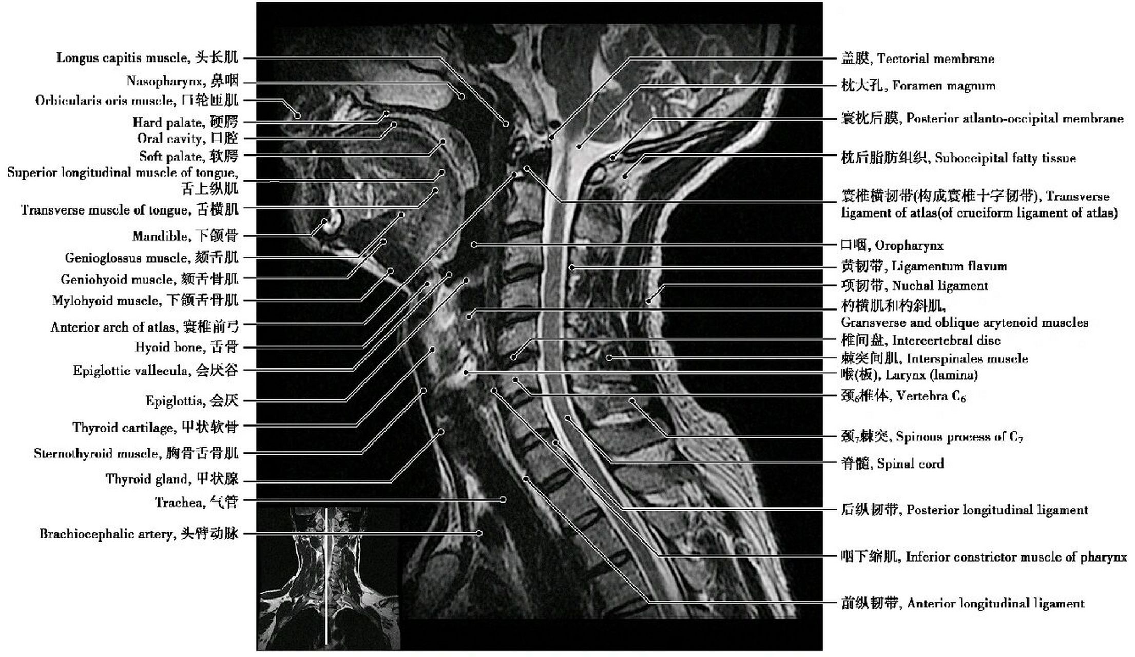 颈椎磁共振解剖(t2wi矢状位)