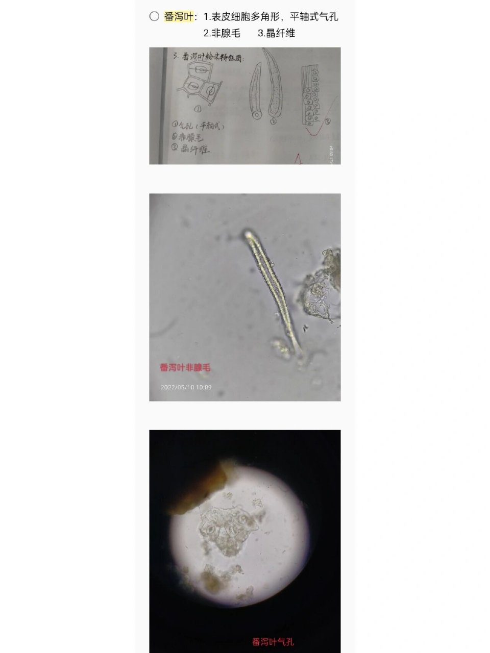 嵌晶纤维,砂晶 3.棕色块 4.表皮细胞碎片 2⃣黄连:1