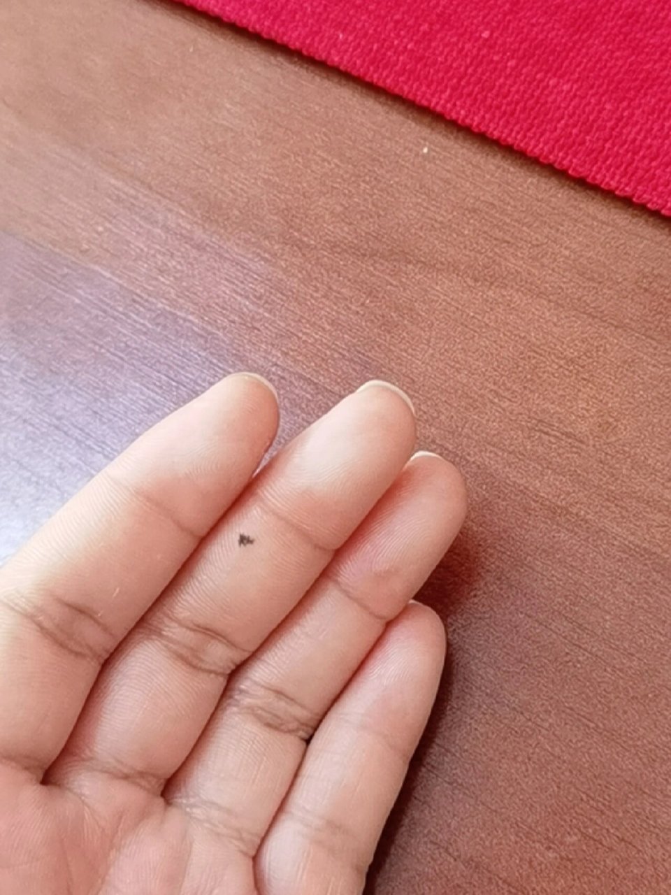 我的手指指腹发白,有人知道是什么原因吗?