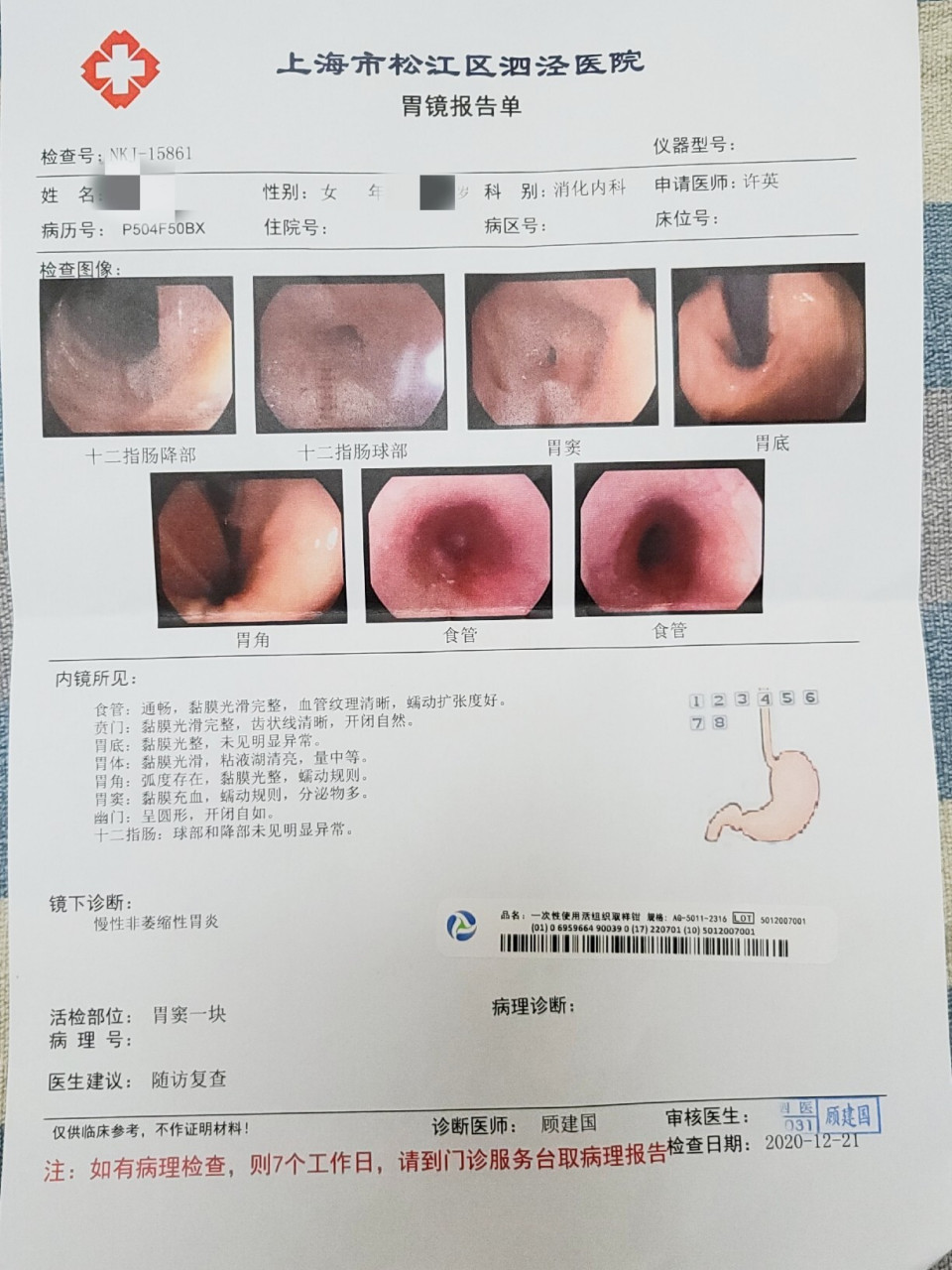 给红薯们说说今天做普通胃镜的感受 地址:上海松江 .