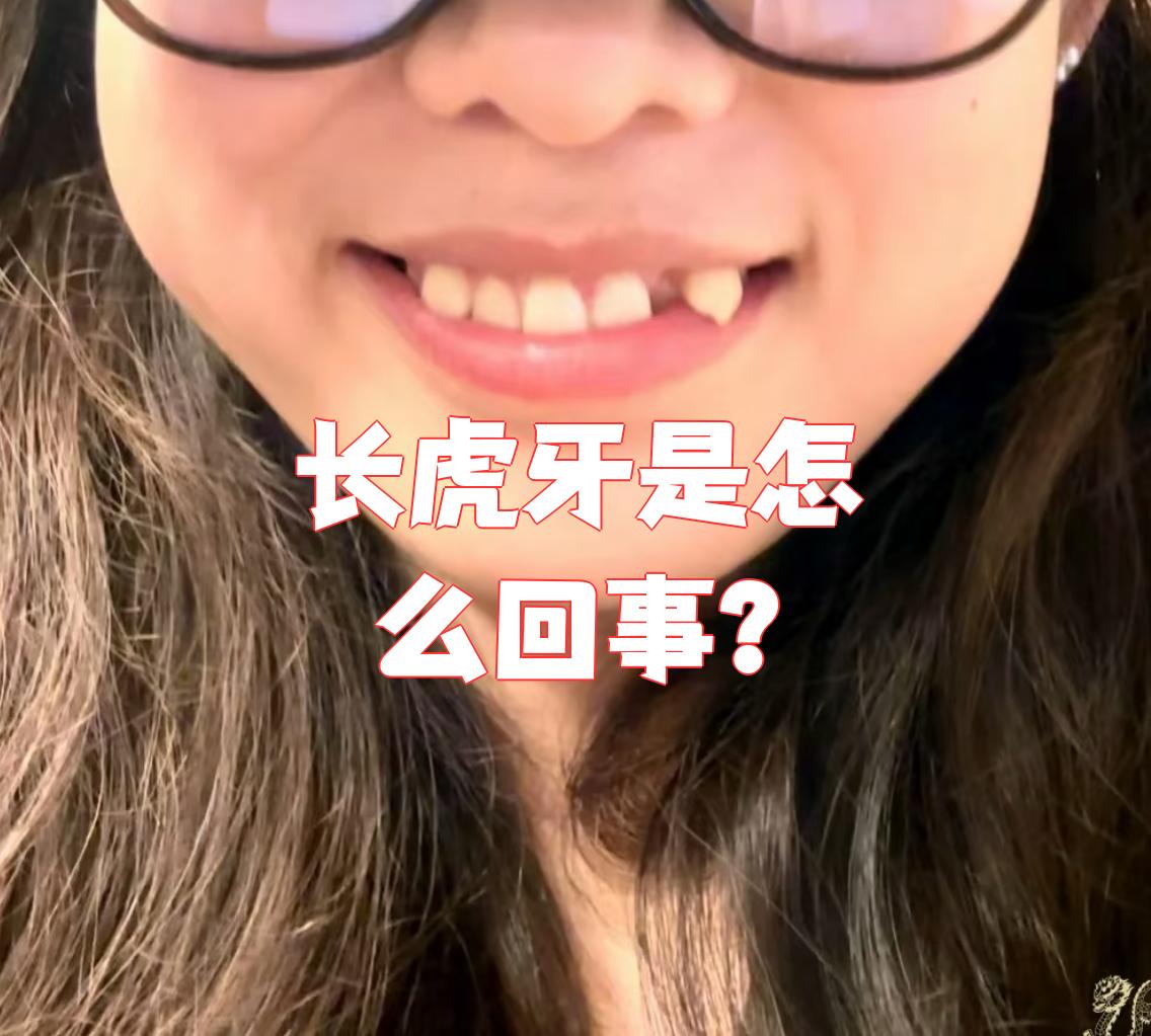 虎牙其实就是上颌尖牙,也就是从门牙往两边数的第三颗牙齿