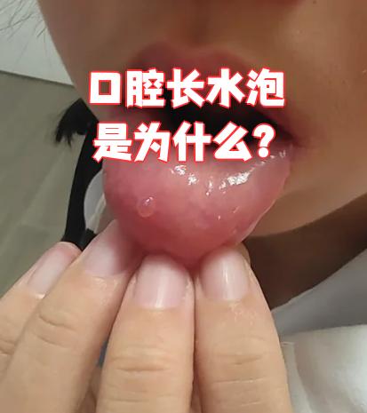 为什么会有水泡