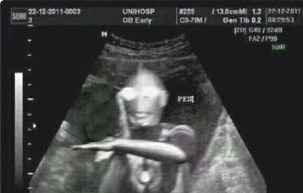 求那个奥特曼b超图