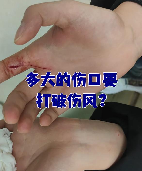 多大的伤口要打破伤风?