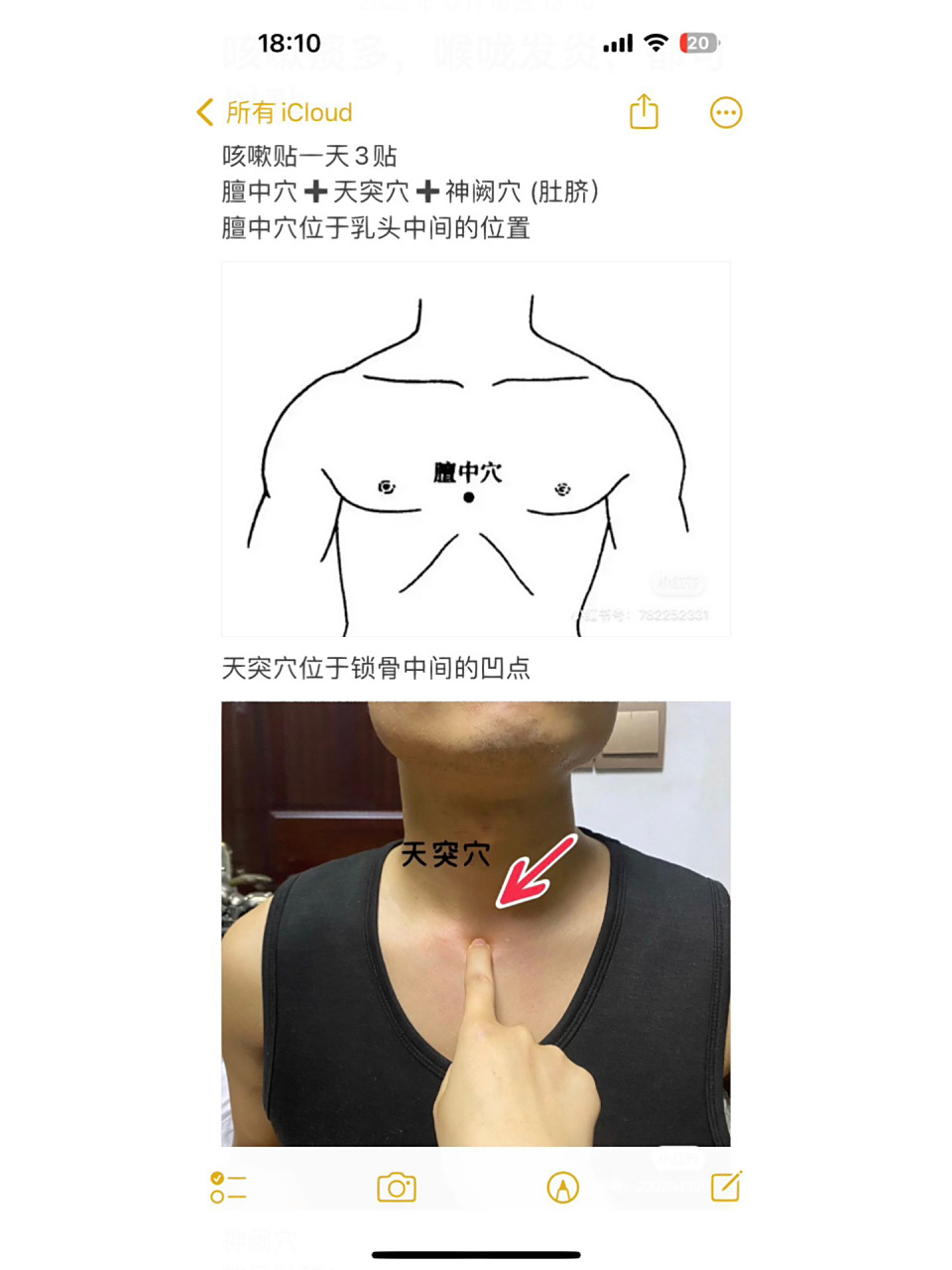 宝宝感冒咳嗽穴位贴! 超实用!配合我们的贴贴,很快就恢复!