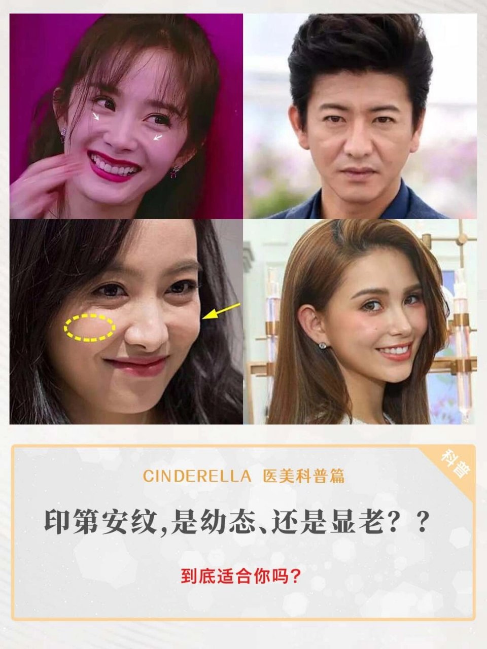 💫娱乐圈有印第安纹的明星不在少数,天王嫂昆凌,最美舞者宋茜,美瘦