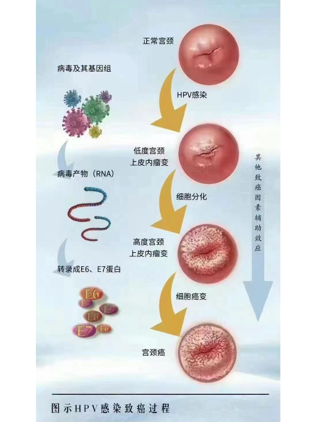 hpv报告出现e6,e7阳性代表什么?