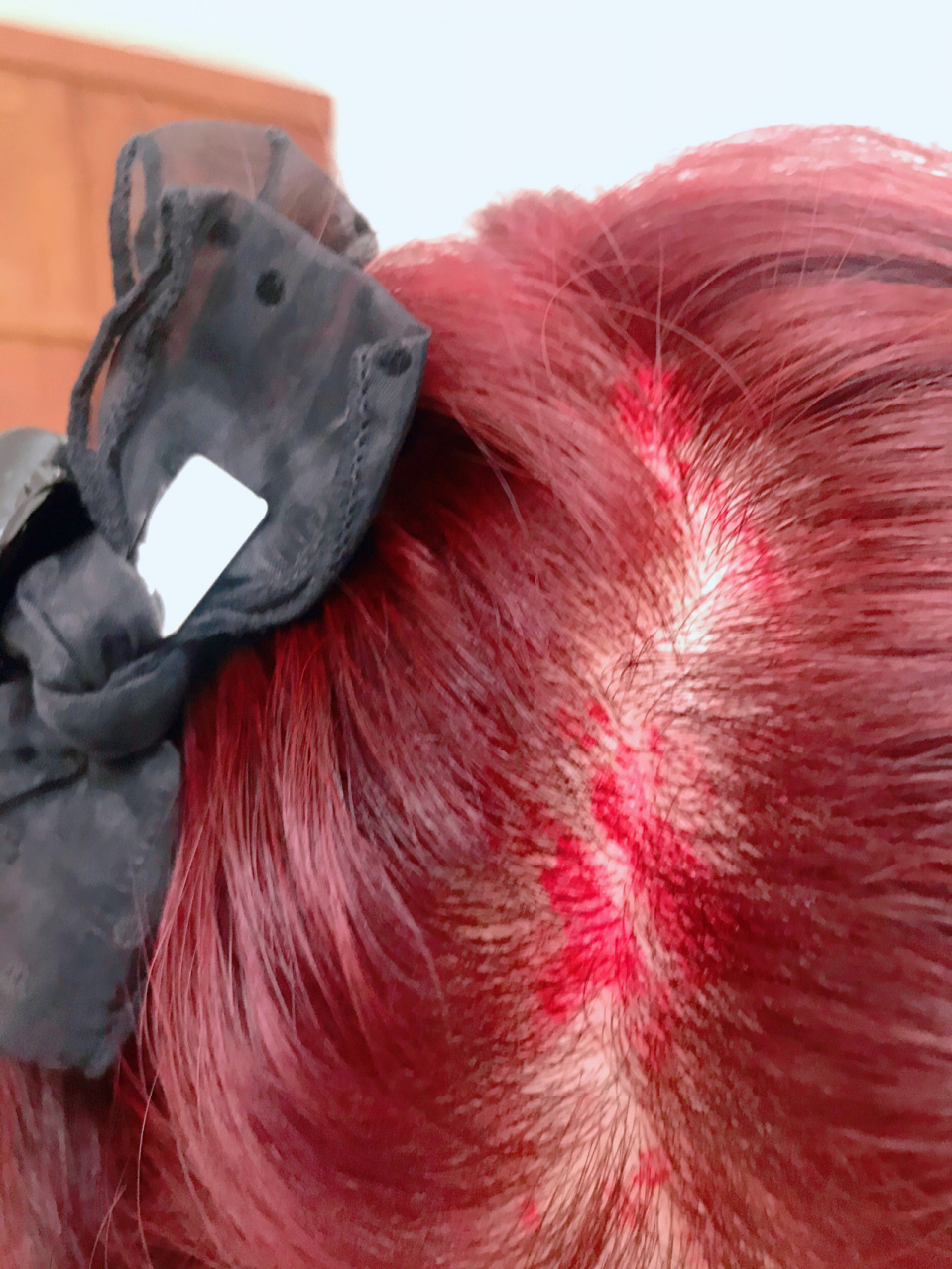 染发染到头皮洗不掉怎么办?