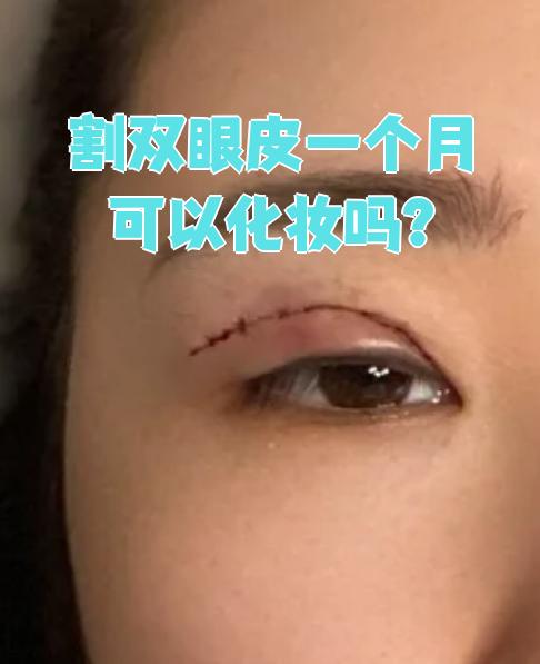 为什么割了双眼皮眼睛还是很小