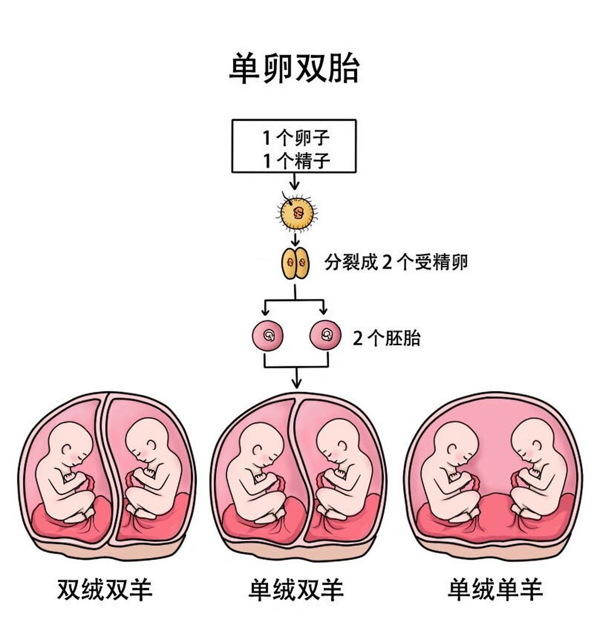 异卵双胞胎怀孕卡通图片