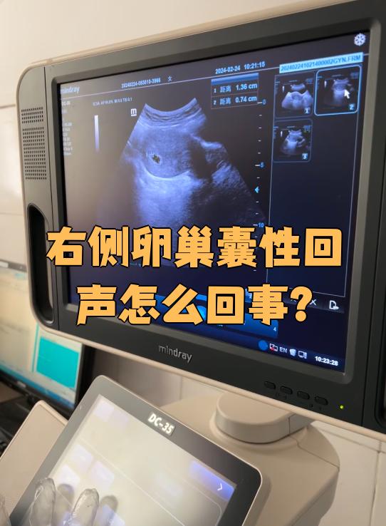 为什么会有回音