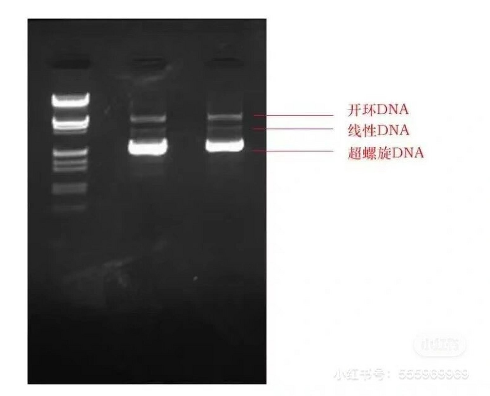rna电泳图中的三条条带图片