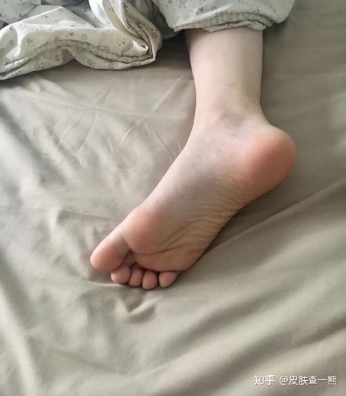 女生的脚怕痒嘛
