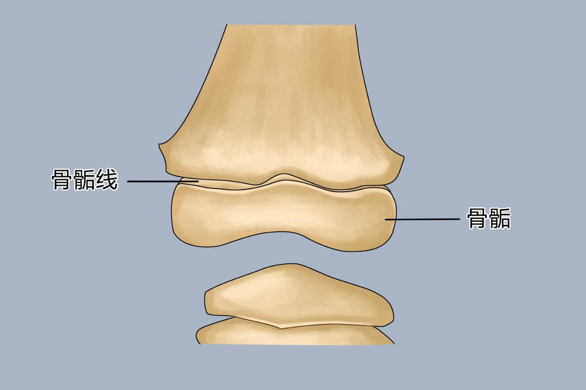 由于未闭合时在x线片上呈横行半透明的线,所以又称为骨骺线,通常表明