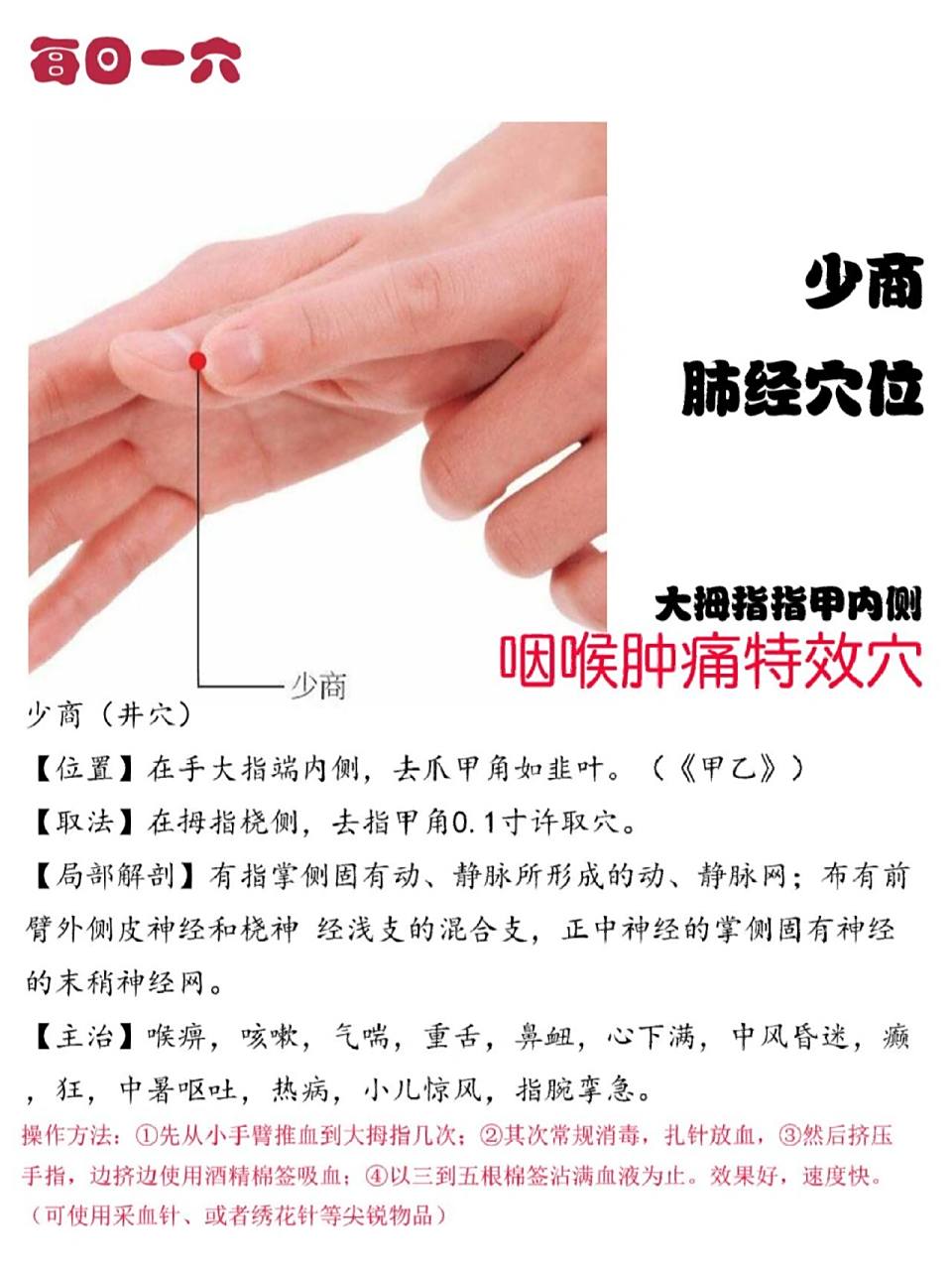 放血疗法——少商 刺络疗法古称刺血络,也称作为刺血