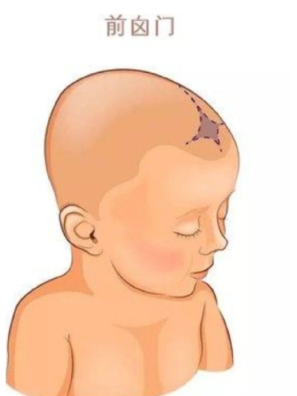 六个月体检,前囟门提前闭合98 我家9242天检查时就说囟门小只有0.