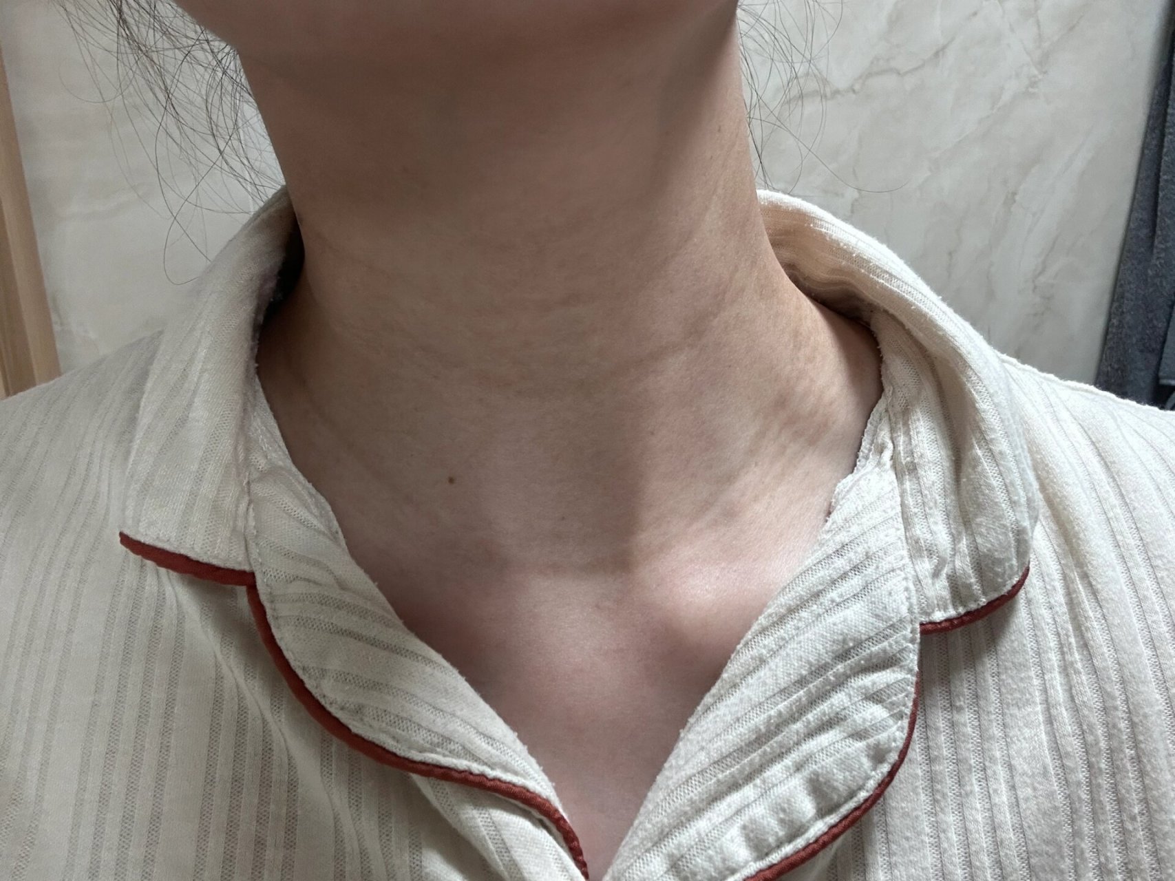 怀孕后颈纹越来越严重05 自从有了颈纹好多漏脖子的衣服都不敢穿