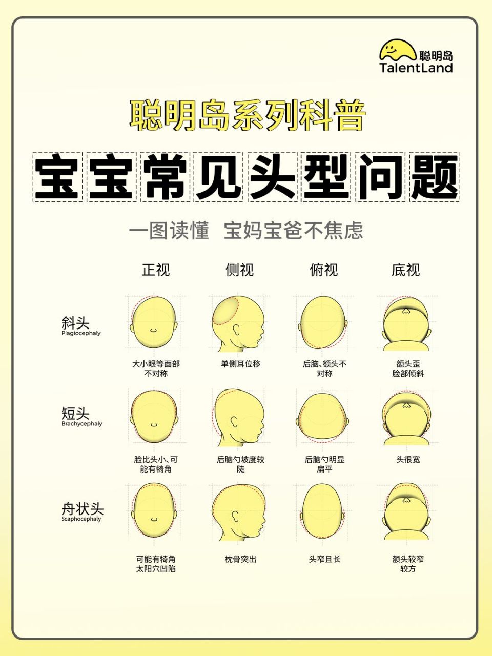 聪明岛系列科普之11566宝宝头型分类大全 99斜头(plagiocephaly