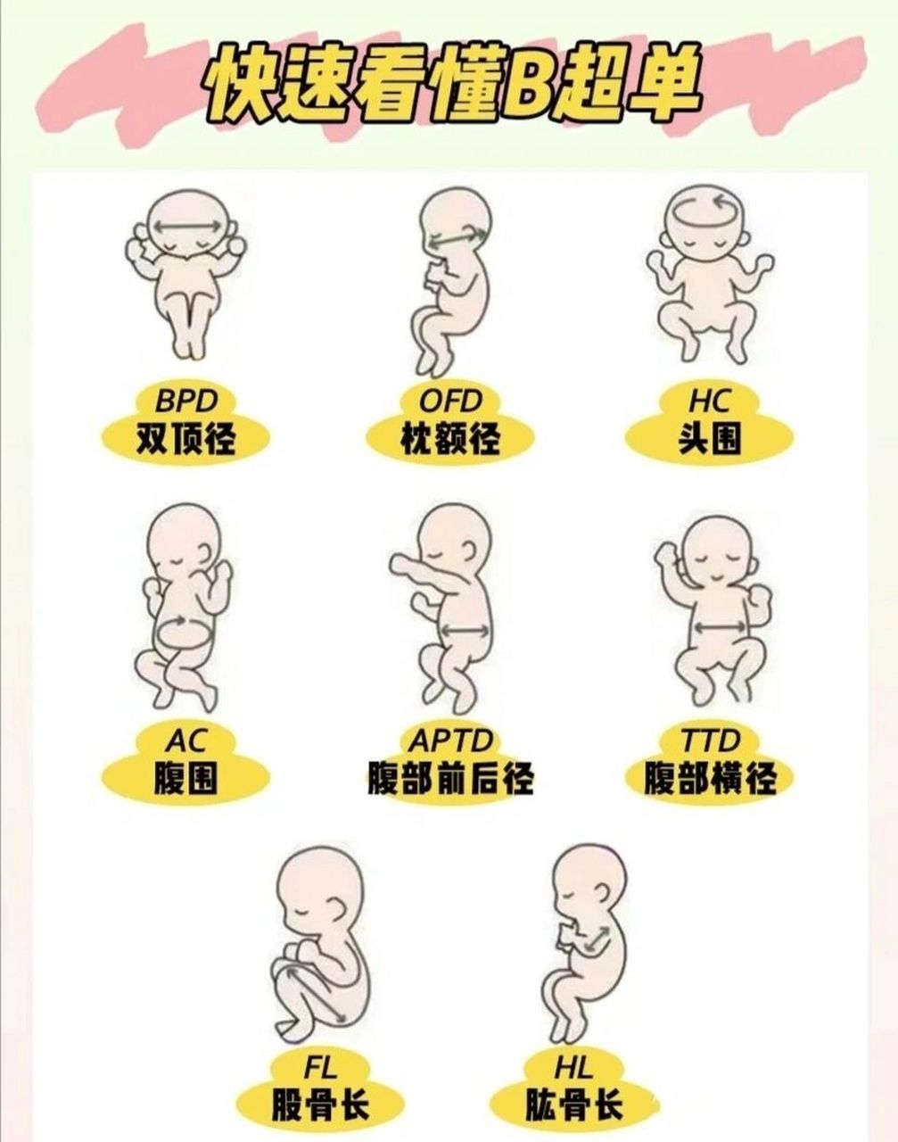 1:1还原29周胎儿大小 今天去医院做了b超,孕周29 1天,回家崽崽爸爸