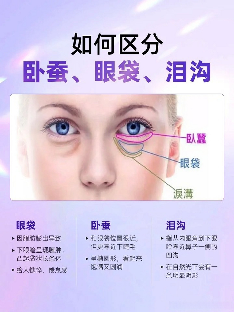 在面部美学中,眼袋,泪沟与卧蚕,这三个看似相似的元素,实则各自承载着
