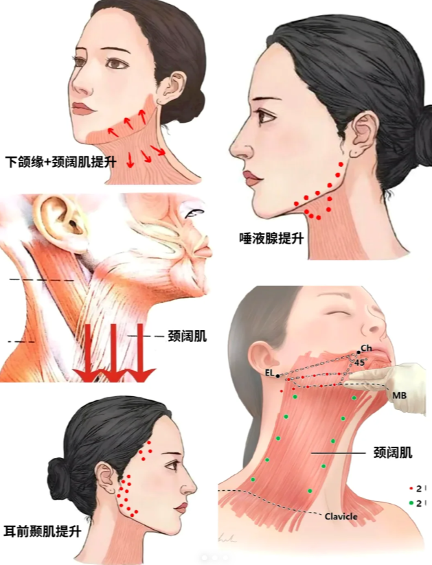 下颚线图图片