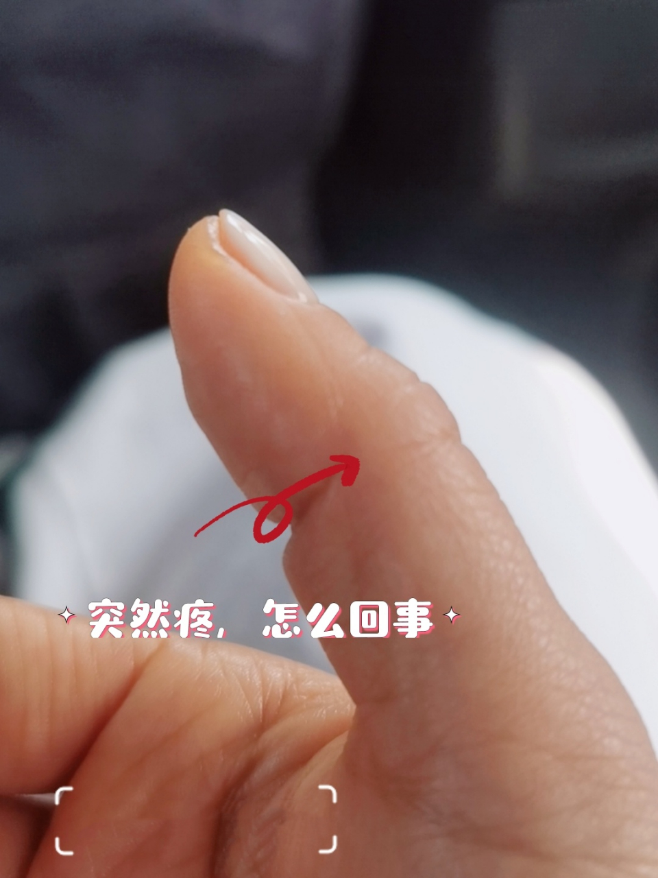 右手大拇指,第一个关节处 突然疼,怎么回