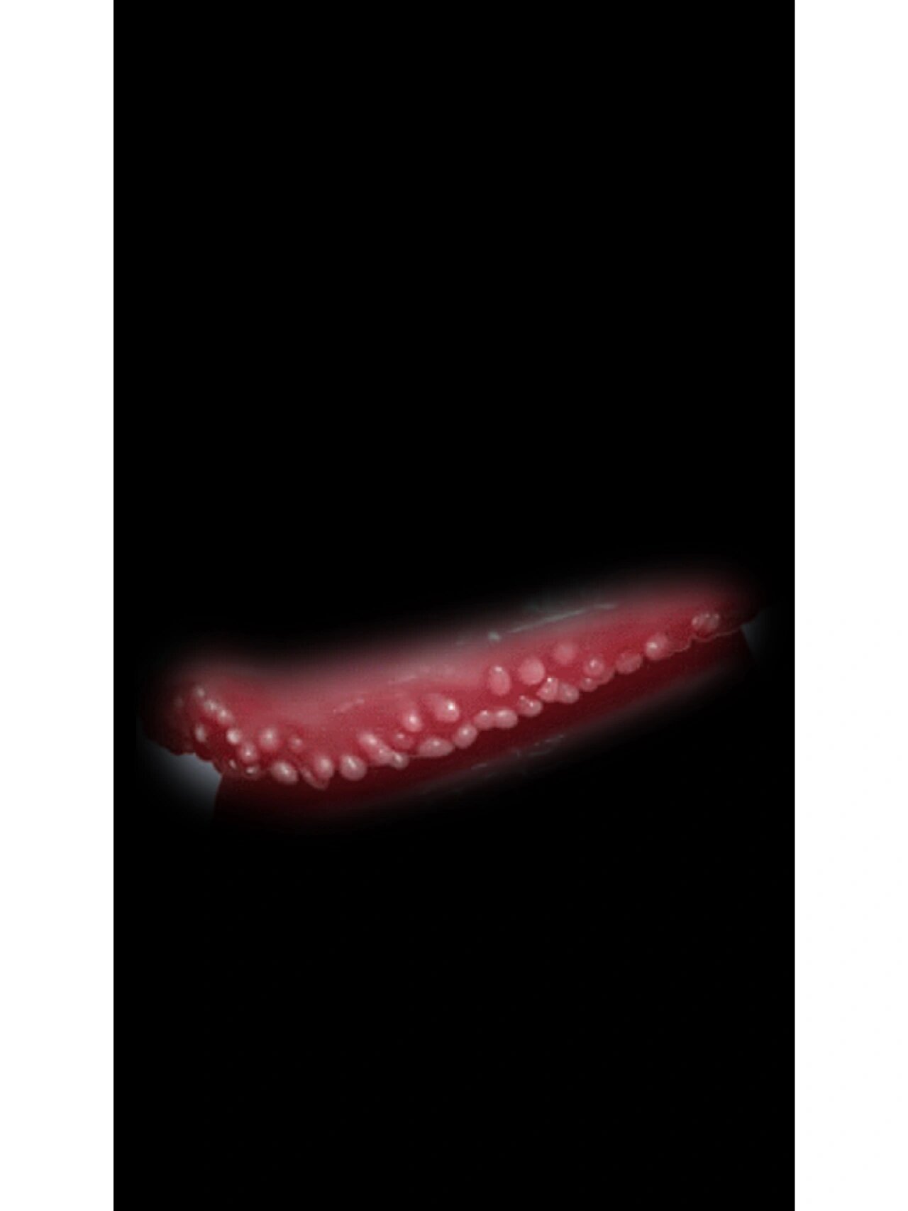 因为珍珠疹不需要处理,是一种良性的生理变异,而需要禁止同房,及早