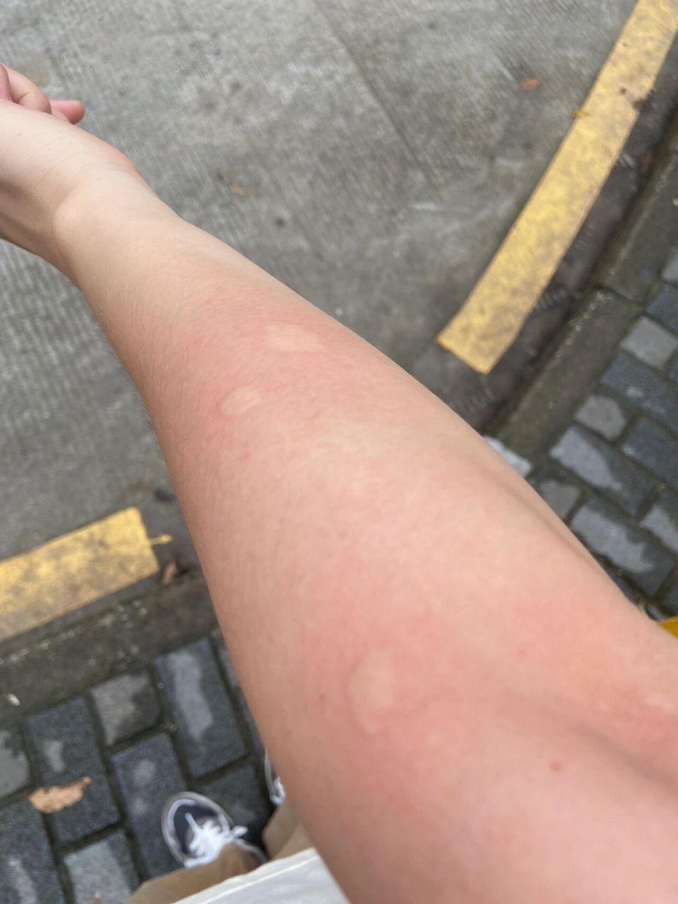 有没有办法消灭咬人的小黑虫 每天下班等车的时候,公交站台很多咬人的