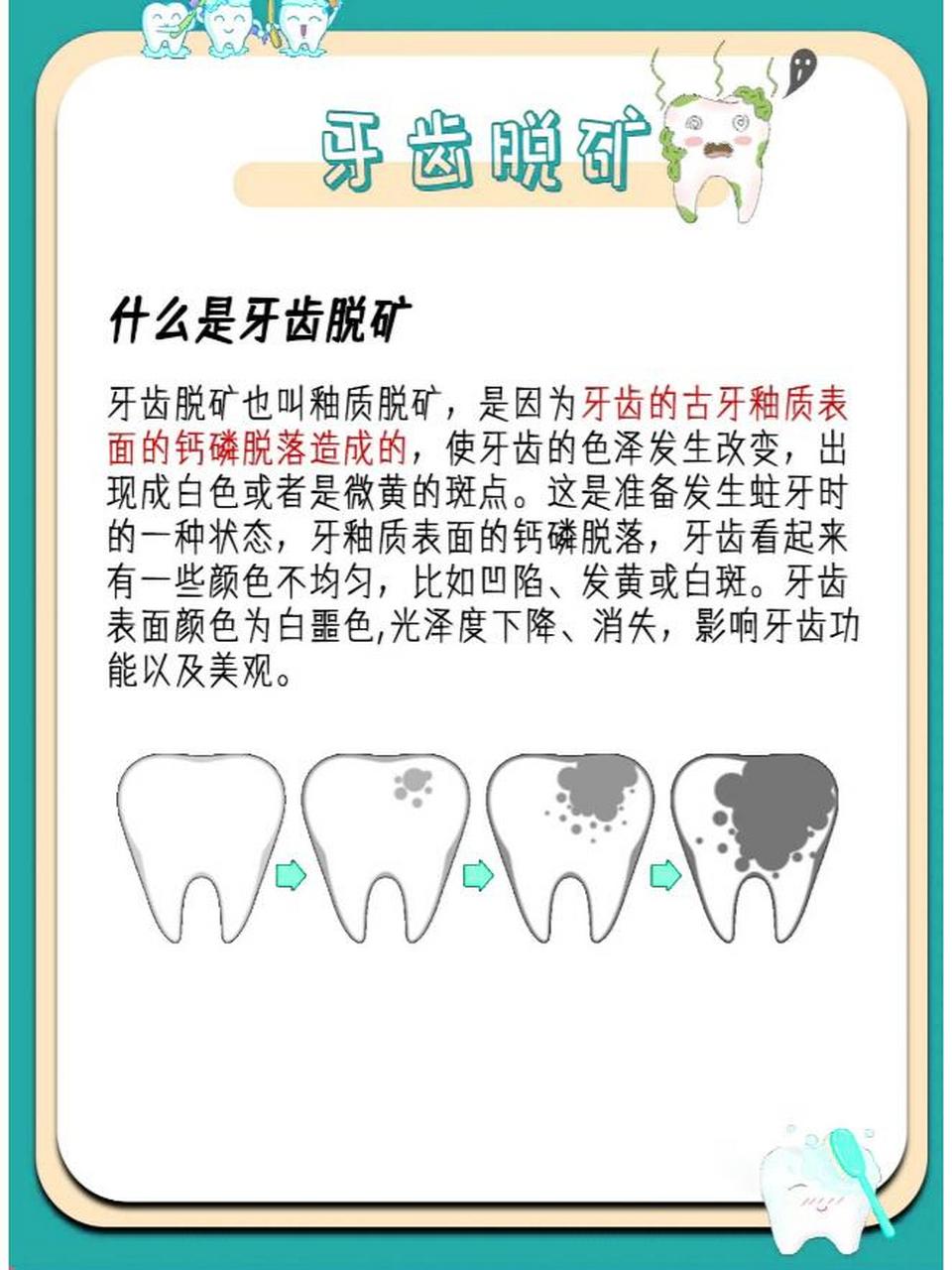 脱矿,也叫脱钙,指人的牙齿牙釉质表面的钙磷脱落,因而使牙齿色泽改变