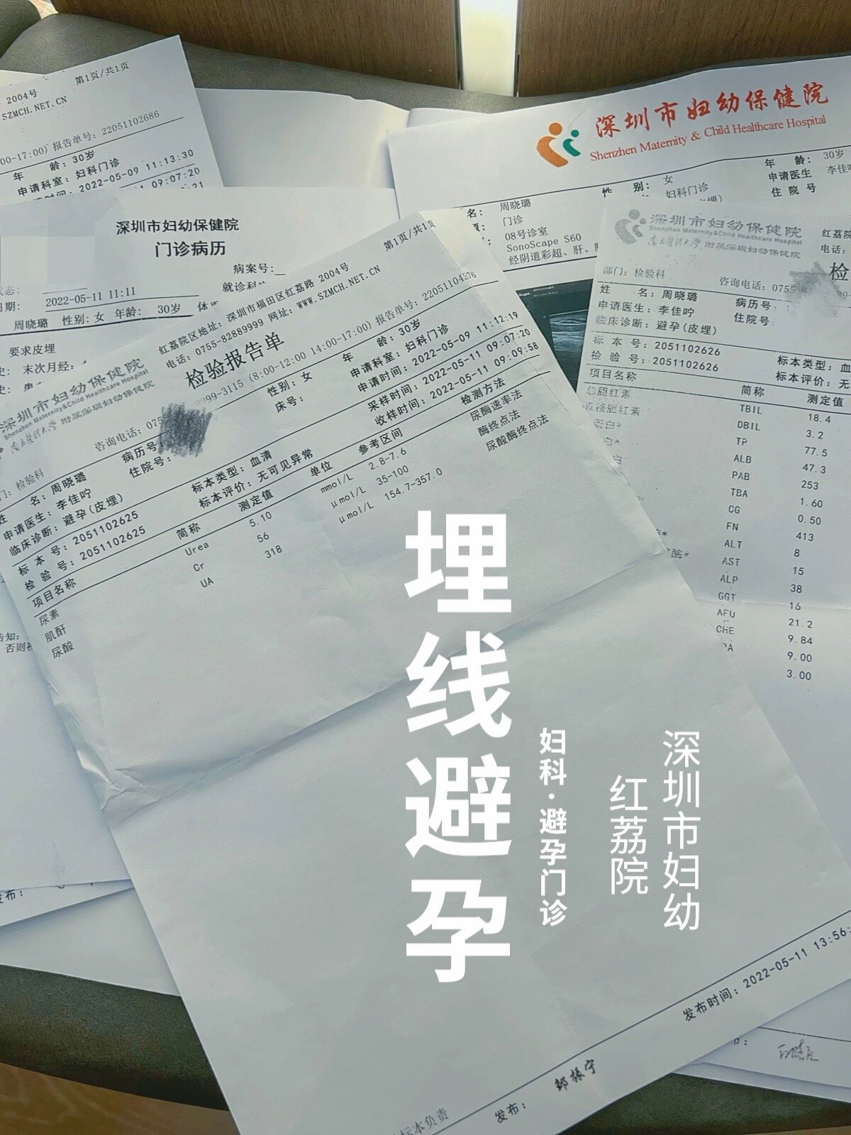 避孕皮埋费用及过程更新