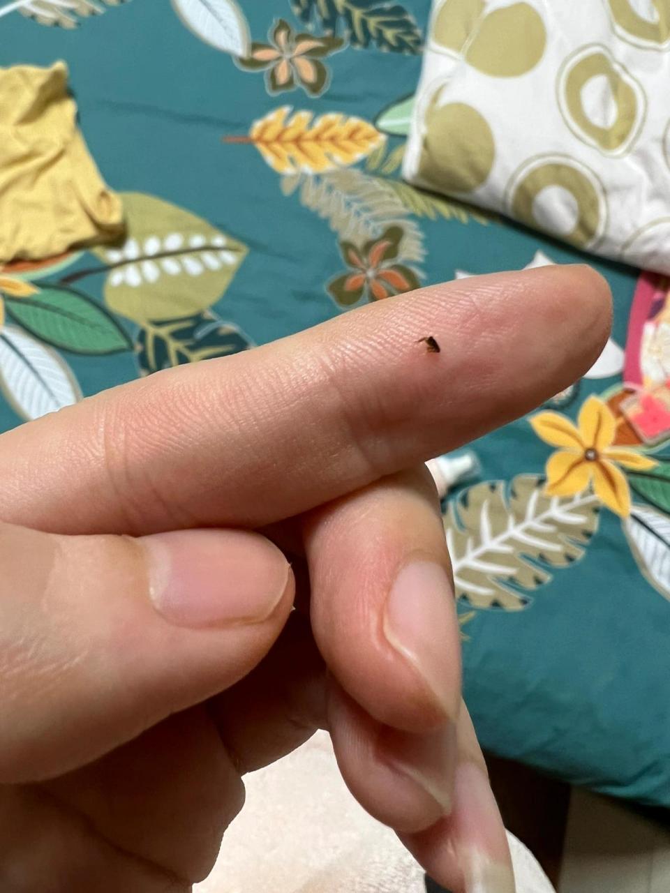 万恶的跳蚤 一家人都被咬了 尤其我妈 最严重 全家人都是第一次见跳蚤