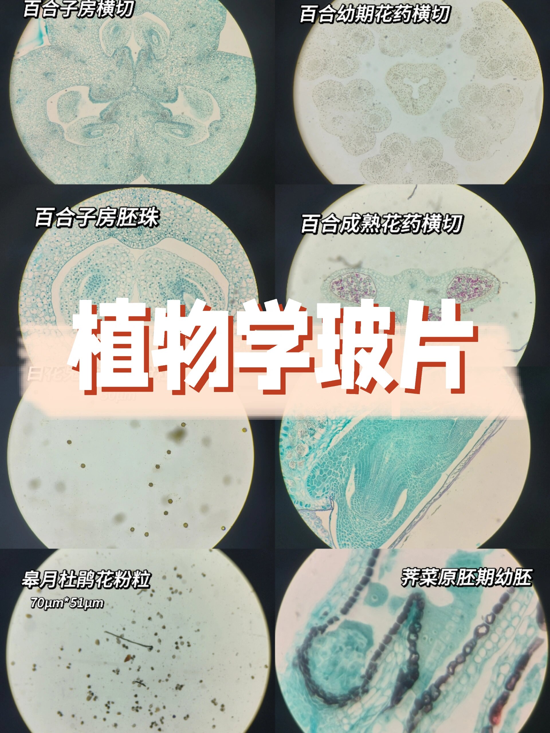 结构 百合子房横切 百合幼期,成熟花药横切 小麦种子纵切 小麦胚 荠菜