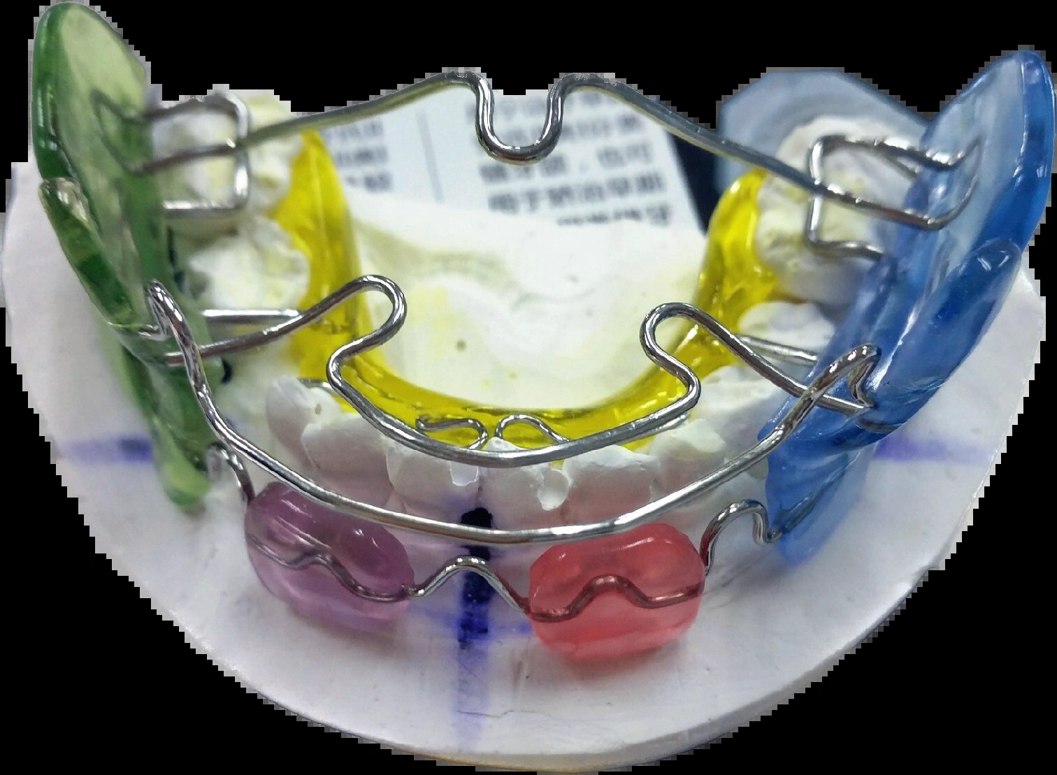 fr法兰克2功能型矫治器(frankell) fr功能调节器(frankel) 作用原理