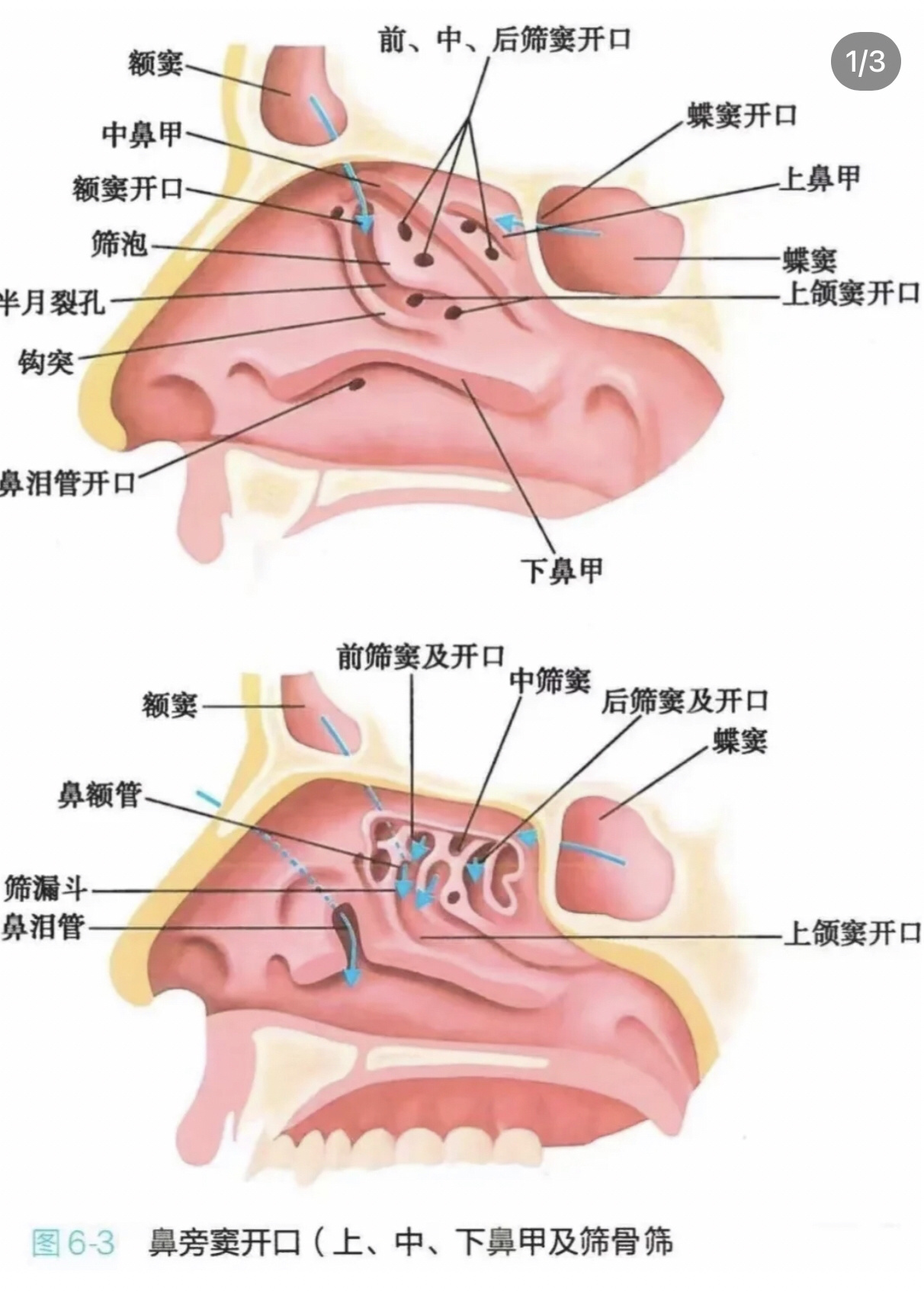 第十一篇:儿童鼻窦炎解析