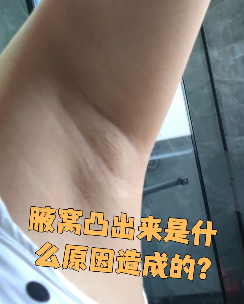 腋窝凸出来通常有几种常见原因,咱们一个一个说清楚