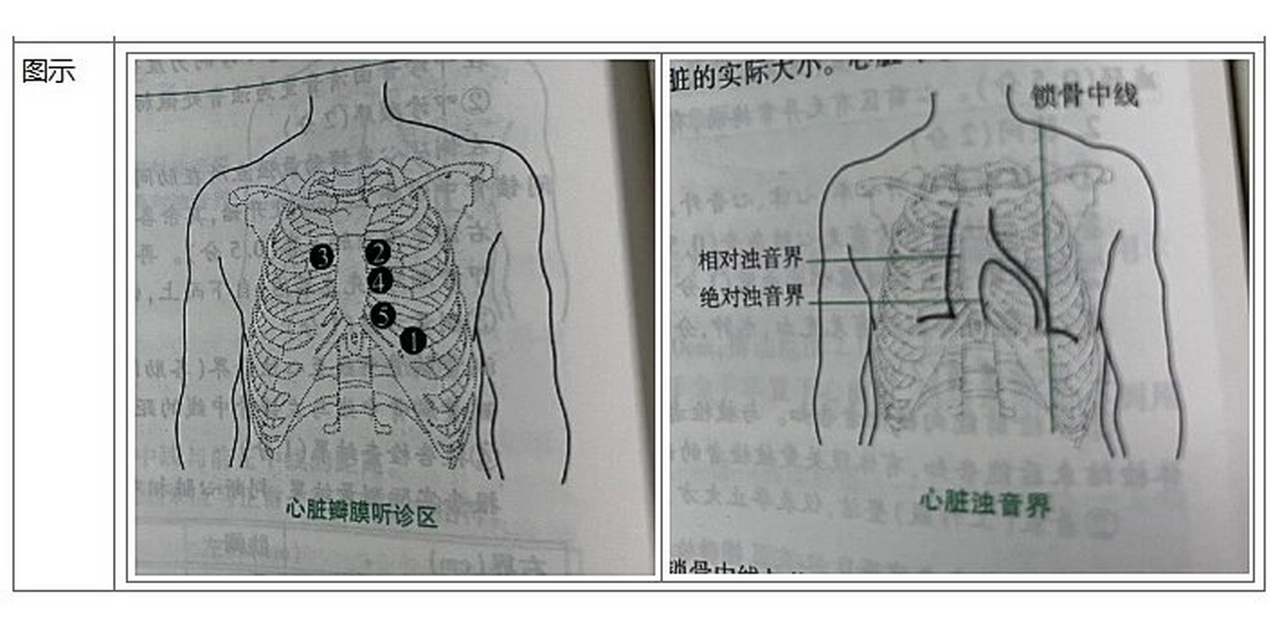 正常心浊音界表格图片图片