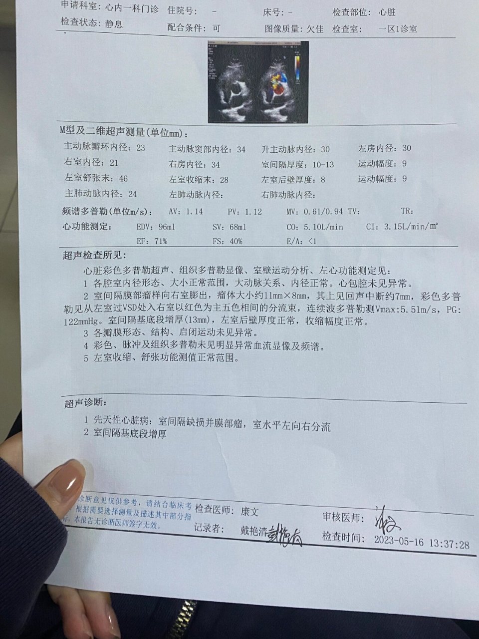 室间隔缺损并膜部瘤 这算严重吗?建议手术吗?