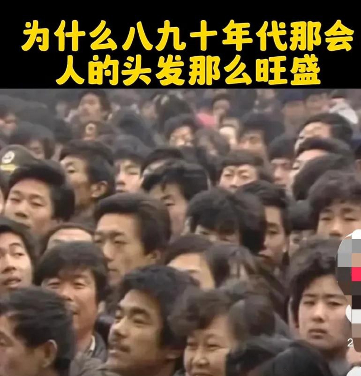为什么八九十年代的人头发那么茂盛,我天天吃维生素abcde,各种肉蛋奶