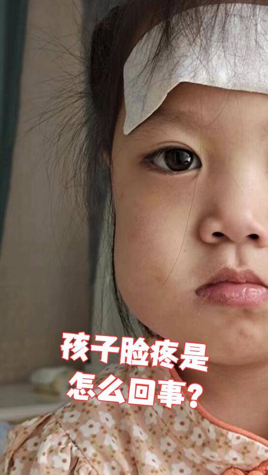 为什么脸疼头疼百科在线