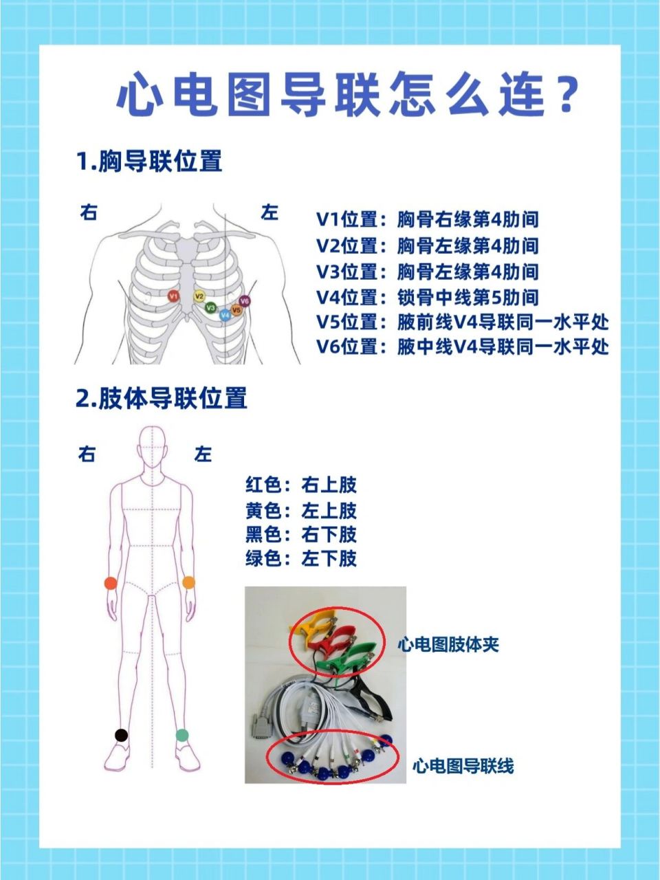 心电图6导联位置口诀图片