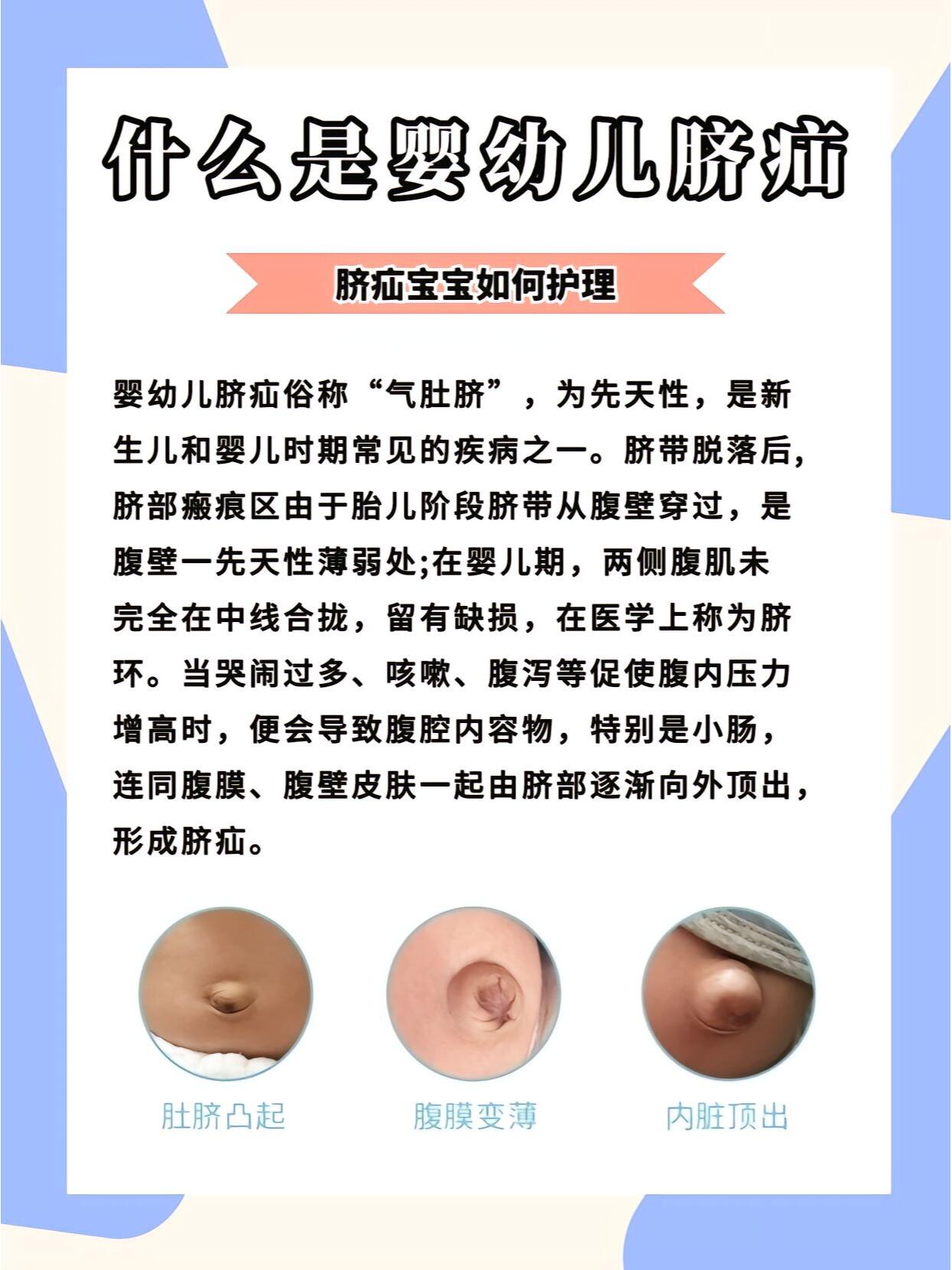 等症状,可以引起从而引发的疼痛 96宝宝肚脐眼突出是什么原因04