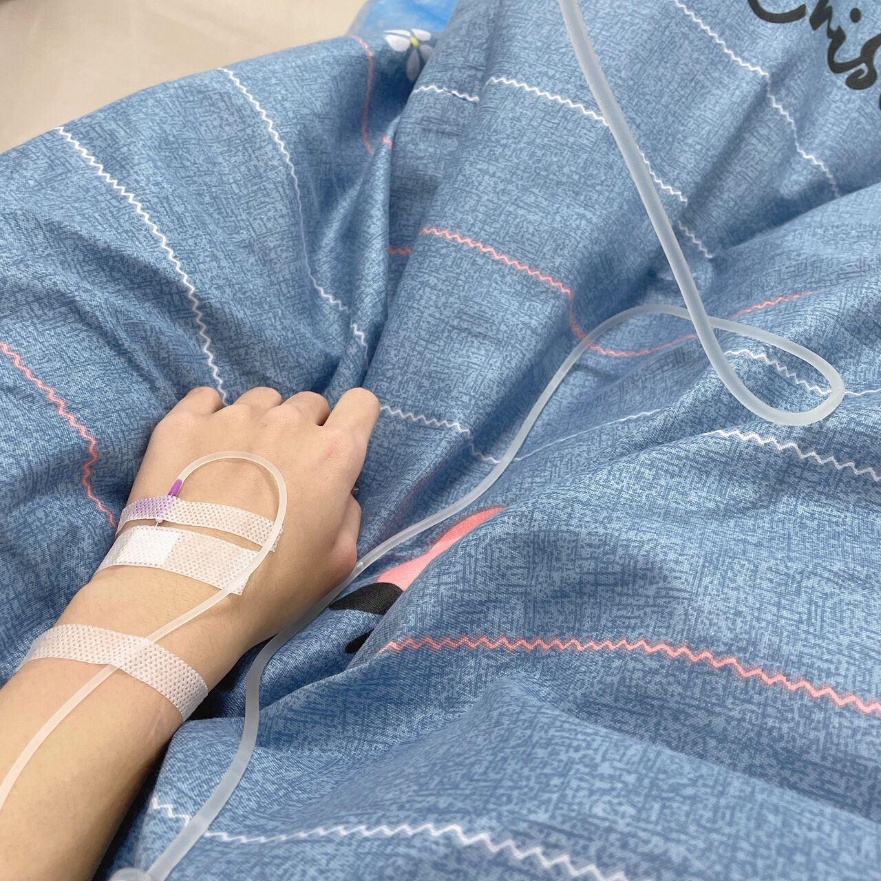 刚开始以为是过敏了,真的要吓